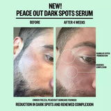 Dark Spots Serum