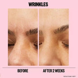 Microneedling Anti-Wrinkle Retinol Patches